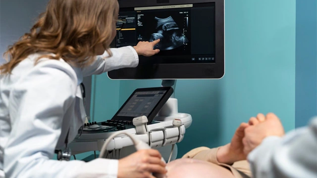 Ultrasound machines